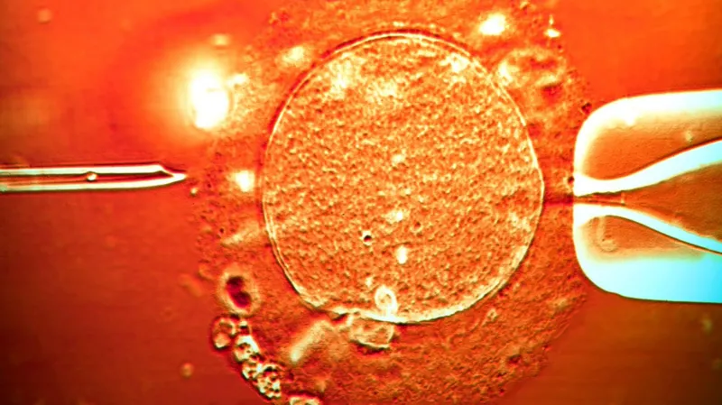 POISONED SEED! Global Scandal as Sperm from Donor with Cancer-Causing Gene Fathers 200 Children