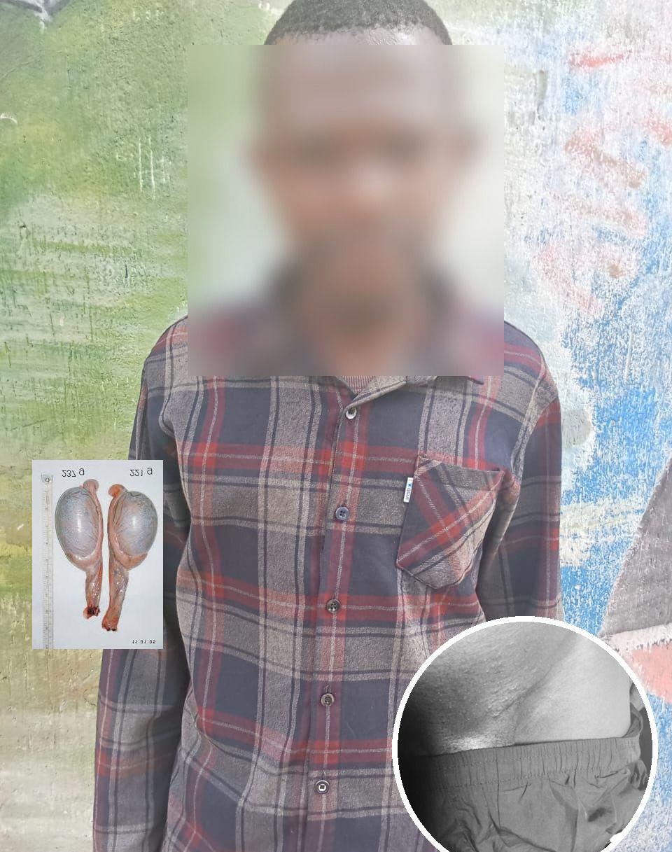 ONE BALL MYEI! Mukono Man Petitions Authorities After Surgery Leaves Him Counting One Instead of Two Balls