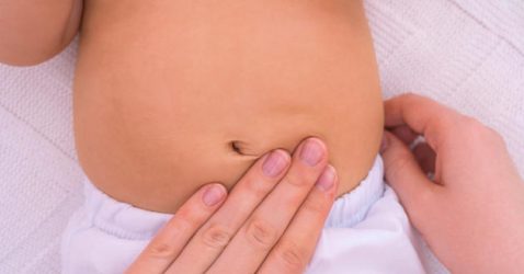Inguinal Swelling in Babies May Be a Sign of Hernia