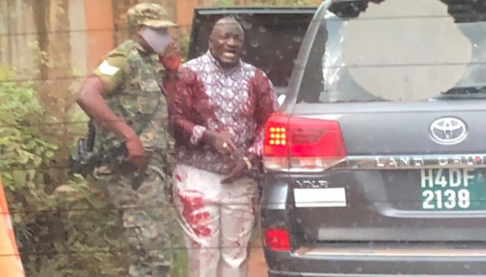 Katumba's Attempted murder; Court confirms charges against six persons - UG Standard