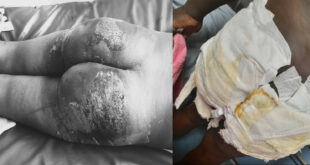 Namara nearly beaten to death by soldier commanded by Major Mark Wanyama