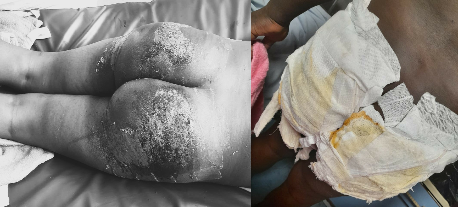 Namara, nearly beaten to death by soldier commanded by Major Mark Wanyama.