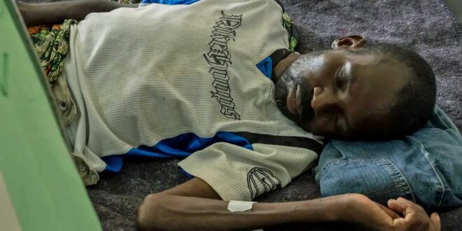 One grim example of how Trump has slashed anti AIDS efforts