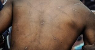 CMI torture victim awarded Shs 172m