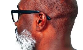 Meat falls from mouth The Observer Media Ltd