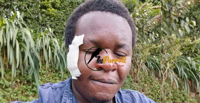 UJA Condemns Police Torture of Journalists Twinamatsiko and Magezi in