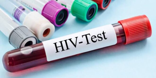 Kabale district registers 653 fresh HIV Infections